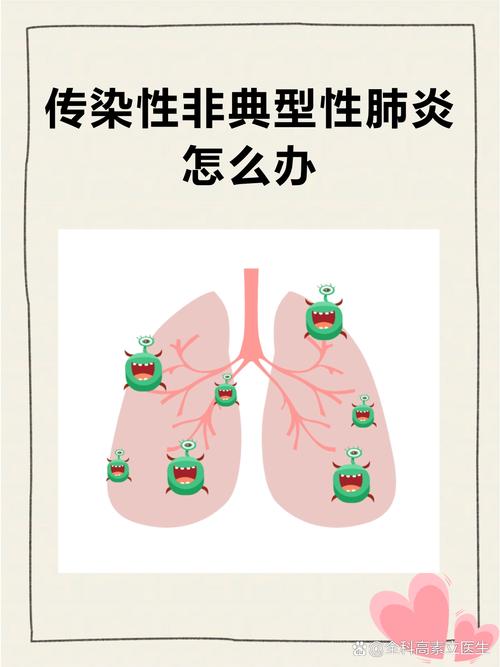 非典与新型肺炎哪个厉害？传染性和严重性对比分析