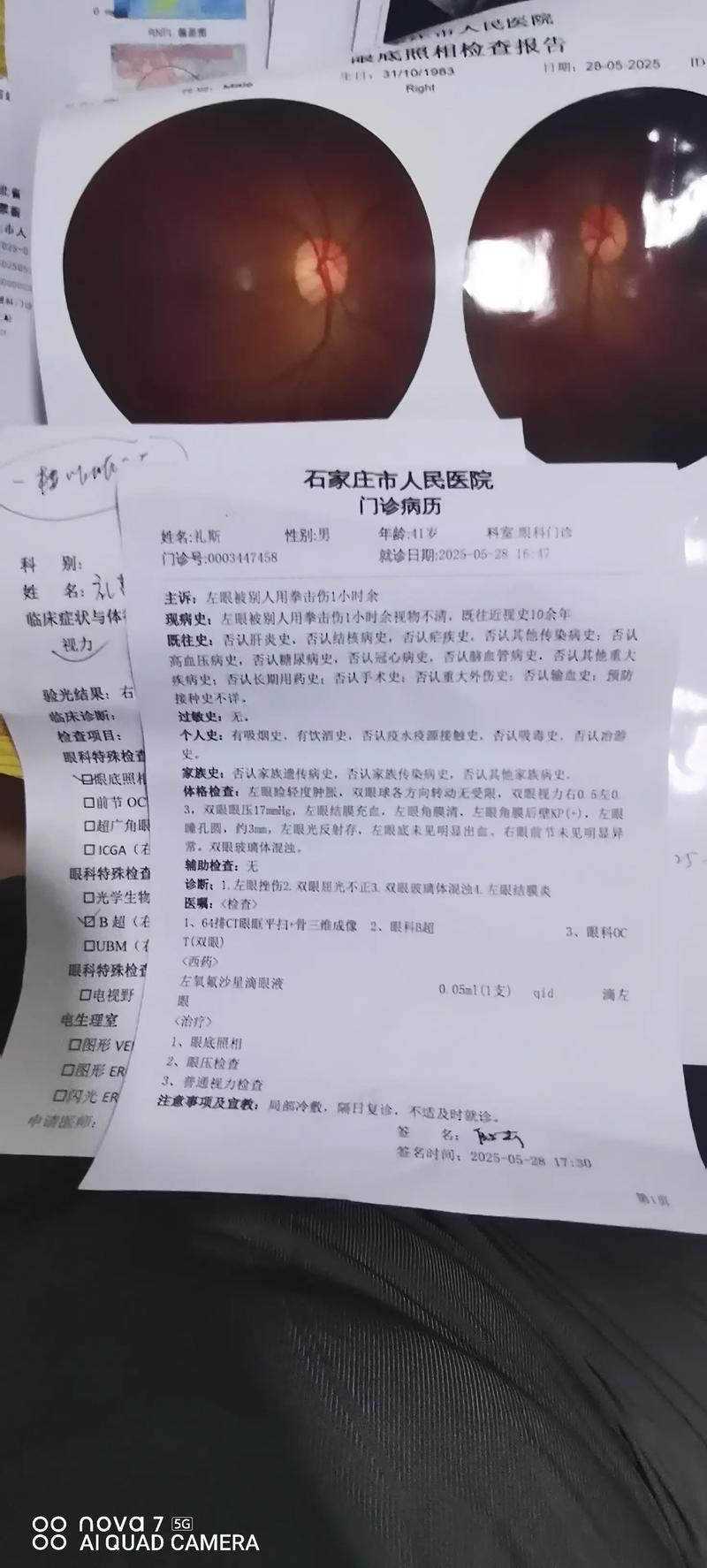 河北现有本土确诊病例数，分别为309例和127例