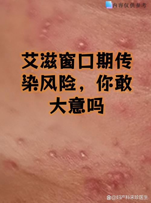 西安疫情属于哪种病毒 德尔塔变异株传染情况